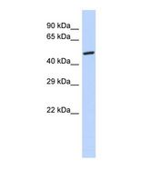 Western blot of Human 293T. GPD2 antibody dilution 1.0 ug/ml.
