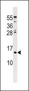 HHLA3 Antibody western blot of HeLa cell line lysates (35 ug/lane). The HHLA3 antibody detected the HHLA3 protein (arrow).