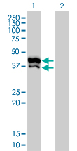 Western Blot analysis of GPD2 expression in transfected 293T cell line by GPD2 monoclonal antibody (M02), clone 2C11-1F4.Lane 1: GPD2 transfected lysate(41 KDa).Lane 2: Non-transfected lysate.