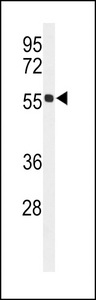 Western blot of HIAT1 Antibody in mouse kidney tissue lysates (35 ug/lane). HIAT1 (arrow) was detected using the purified antibody.