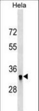 HIBADH Antibody western blot of HeLa cell line lysates (35 ug/lane). The HIBADH antibody detected the HIBADH protein (arrow).