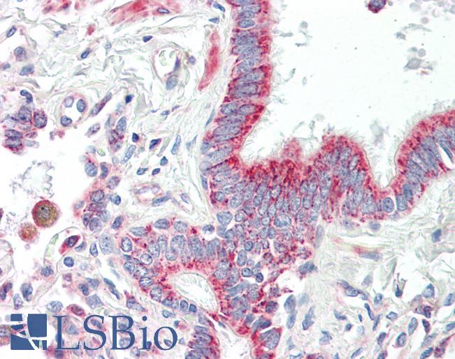 Anti-HIBADH antibody IHC of human lung, respiratory epithelium. Immunohistochemistry of formalin-fixed, paraffin-embedded tissue after heat-induced antigen retrieval. Antibody LS-B8539 dilution 5 ug/ml.