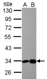 HIBADH antibody detects HIBADH protein by Western blot analysis.A. 30 ug Neuro2A whole cell lysate/extract. 30 ug C8D30 whole cell lysate/extract10 % SDS-PAGEHIBADH antibody dilution: 1:5000
