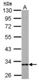 HIBADH antibody detects HIBADH protein by Western blot analysis.A. 30 ug PC-12 whole cell lysate/extract10 % SDS-PAGEHIBADH antibody dilution: 1:1000