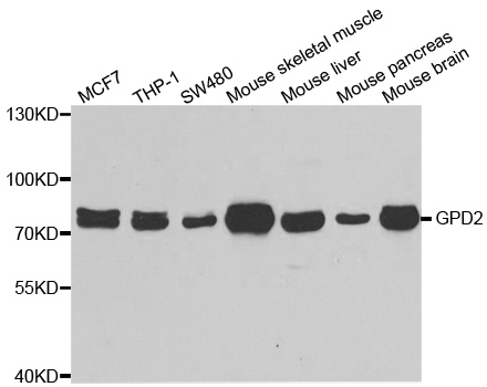 Western blot analysis of extracts of various cell lines, using GPD2 antibody.