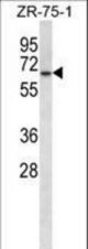 GPD2 Antibody western blot of ZR-75-1 cell line lysates (35 ug/lane). The GPD2 antibody detected the GPD2 protein (arrow).