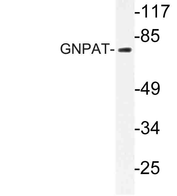 Western blot of GNPAT (F365) pAb in extracts from HT-29 cells.