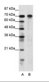 A: Marker, B: Jurkat Cell Lysate