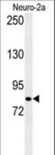 Western blot of CQ028 Antibody in Neuro-2a cell line lysates (35 ug/lane). CQ028 (arrow) was detected using the purified antibody.