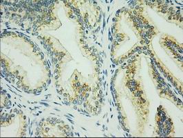 IHC of paraffin-embedded Human prostate tissue using anti-C17orf28 mouse monoclonal antibody. (Dilution 1:50).