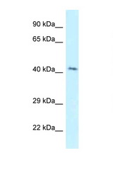 GPER / GPR30 antibody LS-C145746 Western blot of Jurkat Cell lysate. Antibody concentration 1 ug/ml.