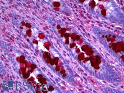 Anti-CLCA1 antibody IHC of human colon, goblet cells. Immunohistochemistry of formalin-fixed, paraffin-embedded tissue after heat-induced antigen retrieval. Antibody LS-B6384 concentration 2.5 ug/ml.