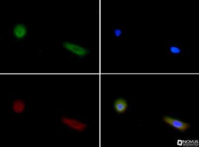 Factor Inhibiting HIF-1 Antibody (FIH 162c) - Western blot of A431 cell lysates.
