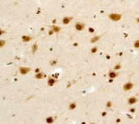IHC of paraffin-embedded human brain tissue using anti-FIH1 antibody (LS-C105594).
