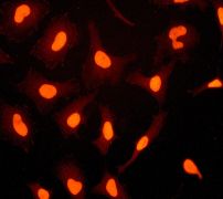 Immunofluorescent staining of HeLa cells using anti-FIH1 antibody (LS-C105594).