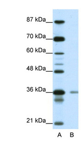 HIF1AN antibody LS-B1535 Western blot of Jurkat lysate.