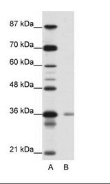 A: Marker, B: Jurkat Cell Lysate