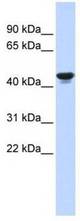 Western analysis of fetal muscle lysate.