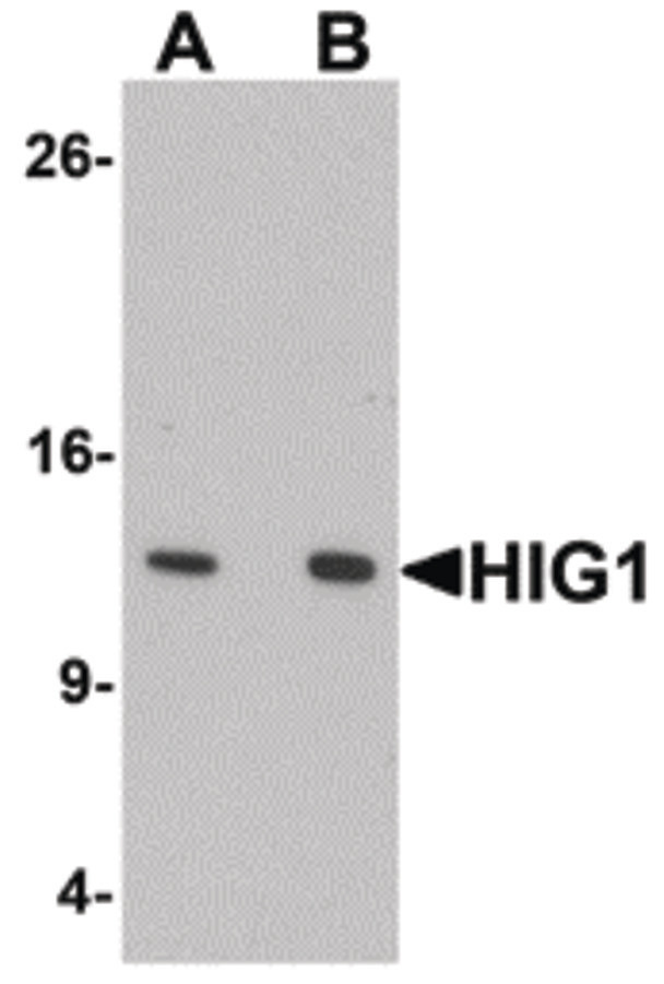 Western blot of HIG1 in 293 cell lysate with HIG1 antibody at at (A) 0.5 and (B) 1 ug/ml.