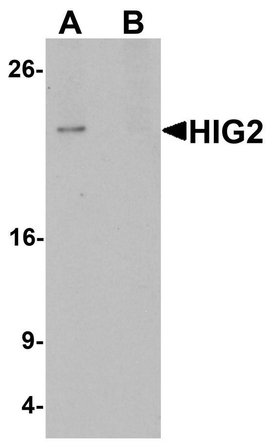 Western blot analysis of HIG2 in 3T3 cell lysate with HIG2 antibody at 1 ug/ml in (A) the absence and (B) the presence of blocking peptide.