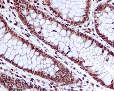 IHC of paraffin-embedded human colon tissue using anti-Hint1 antibody.