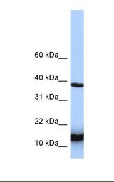 Jurkat cell lysate. Antibody concentration: 1.0 ug/ml. Gel concentration: 10-20%.
