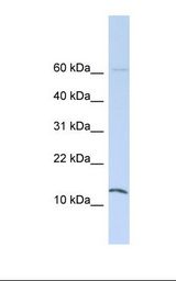 721_B cell lysate. Antibody concentration: 1.0 ug/ml. Gel concentration: 10-20%.