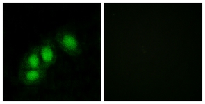 Immunofluorescence of HeLa cells, using HINT1 Antibody. The picture on the right is treated with the synthesized peptide.