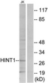 Western blot of extracts from Jurkat cells, using HINT1 Antibody. The lane on the right is treated with the synthesized peptide.