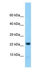 HINT2 antibody Western Blot of Mouse Brain.