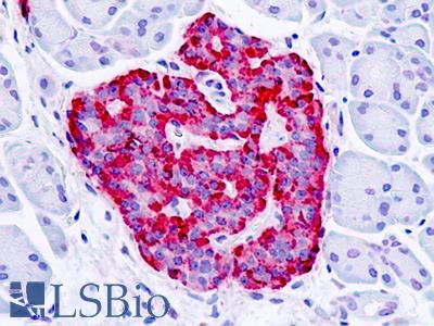 Human, Pancreas, Islet: Formalin-Fixed Paraffin-Embedded (FFPE)
