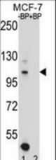 Western blot of HIPK1 Antibody antibody pre-incubated without(lane 1) and with(lane 2) blocking peptide in MCF-7 cell line lysate. HIPK1 Antibody (arrow) was detected using the purified antibody.