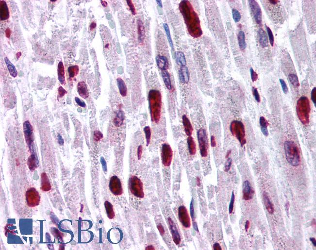 Anti-HIPK2 antibody IHC of human heart. Immunohistochemistry of formalin-fixed, paraffin-embedded tissue after heat-induced antigen retrieval. Antibody LS-B968 concentration 5 ug/ml.