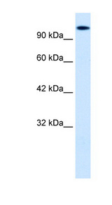 HIPK2 antibody LS-B968 Western blot of HepG2 cell lysate.
