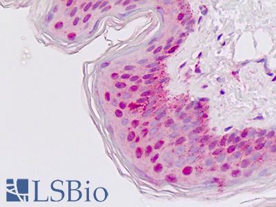Human Skin: Formalin-Fixed, Paraffin-Embedded (FFPE)