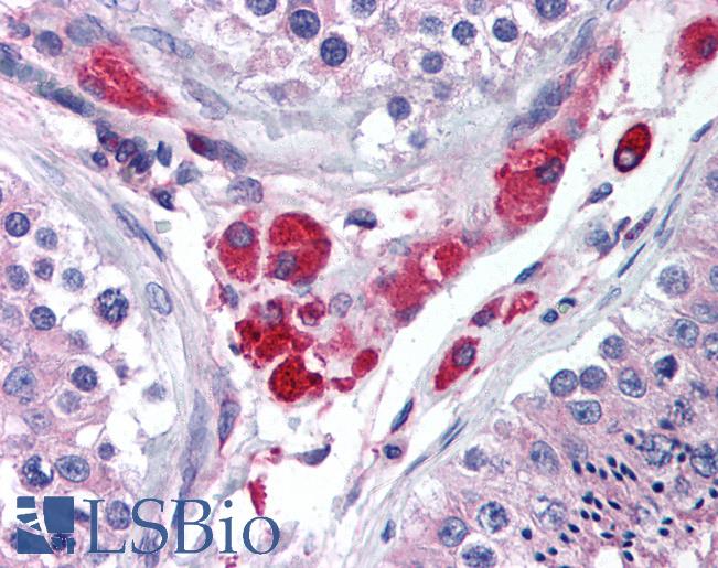 Anti-HIPK3 antibody IHC of human testis. Immunohistochemistry of formalin-fixed, paraffin-embedded tissue after heat-induced antigen retrieval. Antibody LS-B1805 concentration 10 ug/ml.