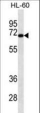 HIPK4 Antibody western blot of HL-60 cell line lysates (35 ug/lane). The HIPK4 antibody detected the HIPK4 protein (arrow).