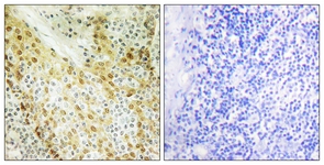 IHC of paraffin-embedded human tonsil tissue, using HIRA Antibody. The picture on the right is treated with the synthesized peptide.