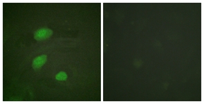 Immunofluorescence of HeLa cells, using HIRA (Phospho-Thr555) Antibody. The sample on the right was incubated with synthetic peptide.