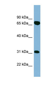 HIRIP3 antibody LS-C108070 Western blot of ACHN lysate.