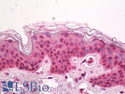 Anti-HIRIP3 antibody IHC of human skin. Immunohistochemistry of formalin-fixed, paraffin-embedded tissue after heat-induced antigen retrieval. Antibody LS-B7926 dilution 5 ug/ml.