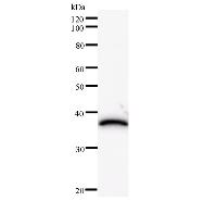 Western blot analysis of immunized recombinant protein, using anti-HIRIP3 monoclonal antibody.