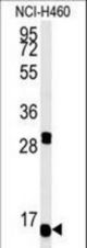 Western blot of HIST1H1B Antibody in NCI-H460 cell line lysates (35 ug/lane). HIST1H1B (arrow) was detected using the purified antibody.
