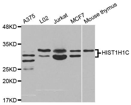 Western blot analysis of extracts of various cell lines, using HIST1H1C antibody.