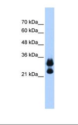 721_B cell lysate. Antibody concentration: 0.25 ug/ml. Gel concentration: 12%.