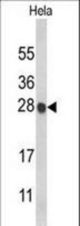 Western blot of HIST1H1C Antibody in HeLa cell line lysates (35 ug/lane). HIST1H1C (arrow) was detected using the purified antibody.