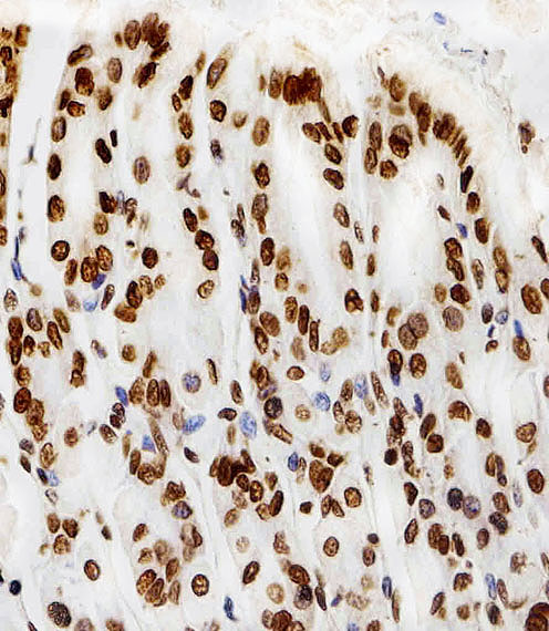 Immunohistochemical of paraffin-embedded M. stomach section using HIST1H2AG Antibody. Antibody was diluted at 1:100 dilution. A peroxidase-conjugated goat anti-rabbit IgG at 1:400 dilution was used as the secondary antibody, followed by DAB staining.