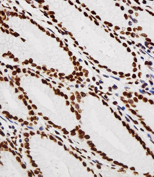 Immunohistochemical of paraffin-embedded M. testis section using H. stomach Antibody. Antibody was diluted at 1:100 dilution. A peroxidase-conjugated goat anti-rabbit IgG at 1:400 dilution was used as the secondary antibody, followed by DAB staining.