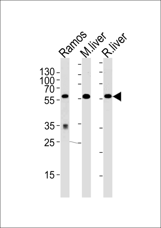 Western blot of lysates from Ramos cell line,mouse liver,rat liver tissue (from left to right),using GPI Antibody. Antibody was diluted at 1:1000 at each lane. A goat anti-rabbit IgG H&L (HRP) at 1:5000 dilution was used as the secondary antibody.Lysates at 35ug per lane.