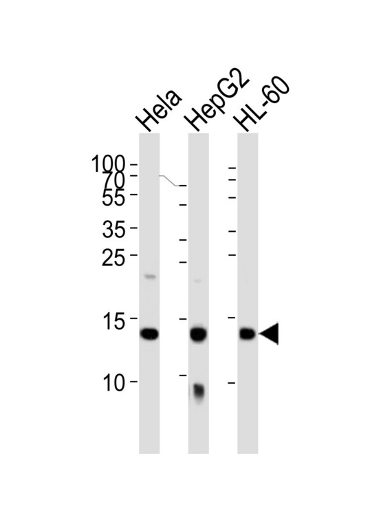 Western blot of lysates from HeLa, HepG2, HL-60 cell line (from left to right) with HIST1H2AG Antibody. Antibody was diluted at 1:1000 at each lane. A goat anti-rabbit IgG H&L (HRP) at 1:5000 dilution was used as the secondary antibody. Lysates at 35 ug per lane.